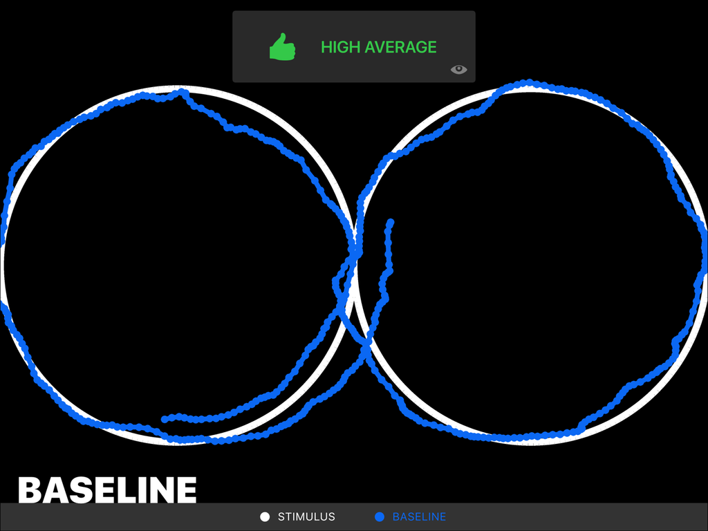ワールドラグビー 脳震盪の識別と管理の補助となる最新のアイトラッキング技術を探究 ワールドラグビー